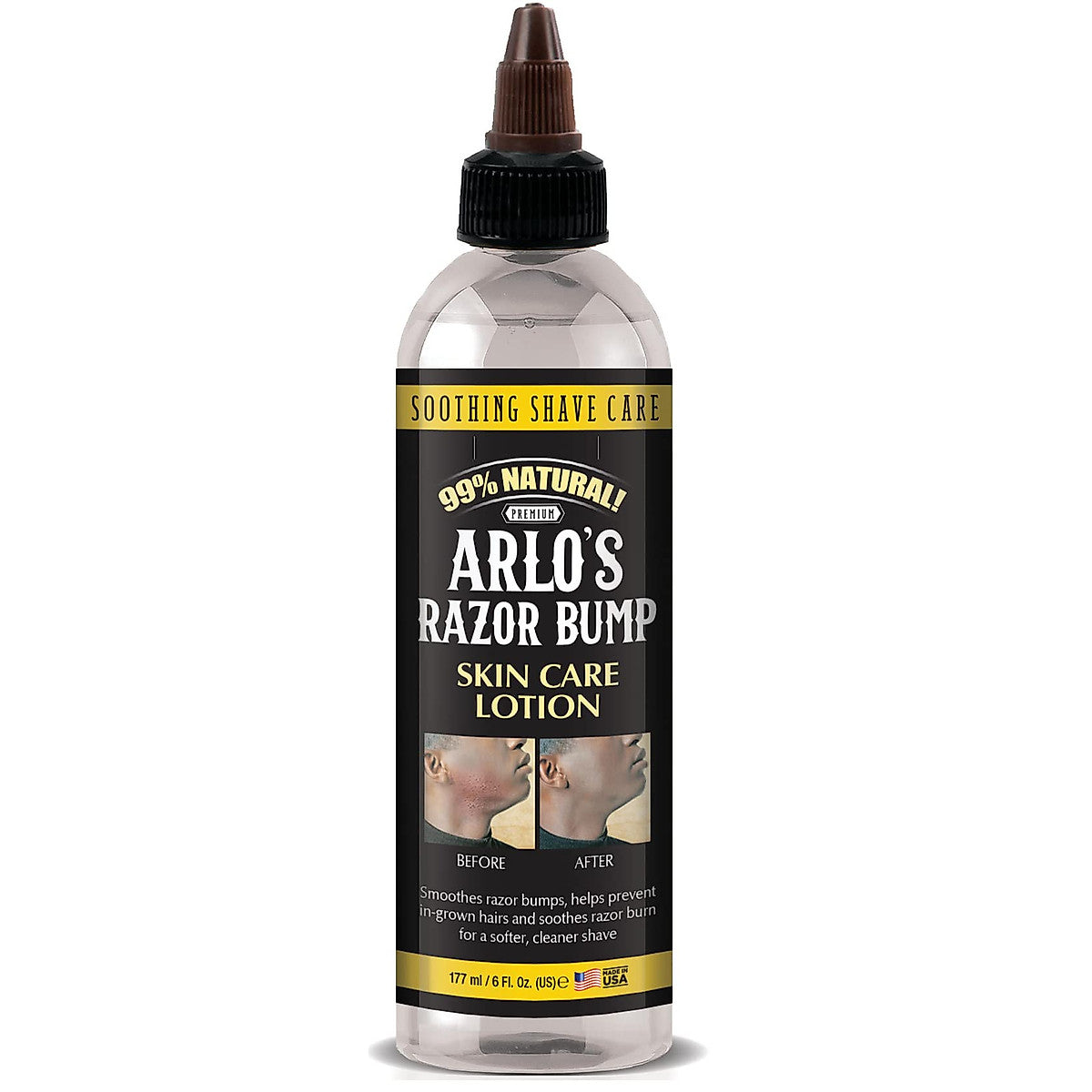 Arlos Razor Bump Lotion 6oz